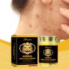 Ximonth Herbal Mosquito Itch Relief Cream, A Mild Herbal Formula To Protect Against Mosquito Bites, Soothing And Long-Lasting